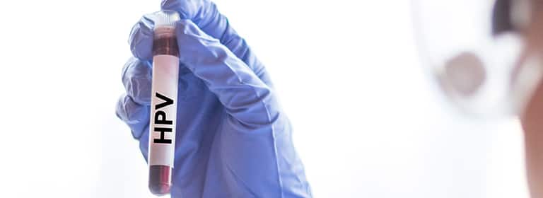 Come si cura il papilloma virus